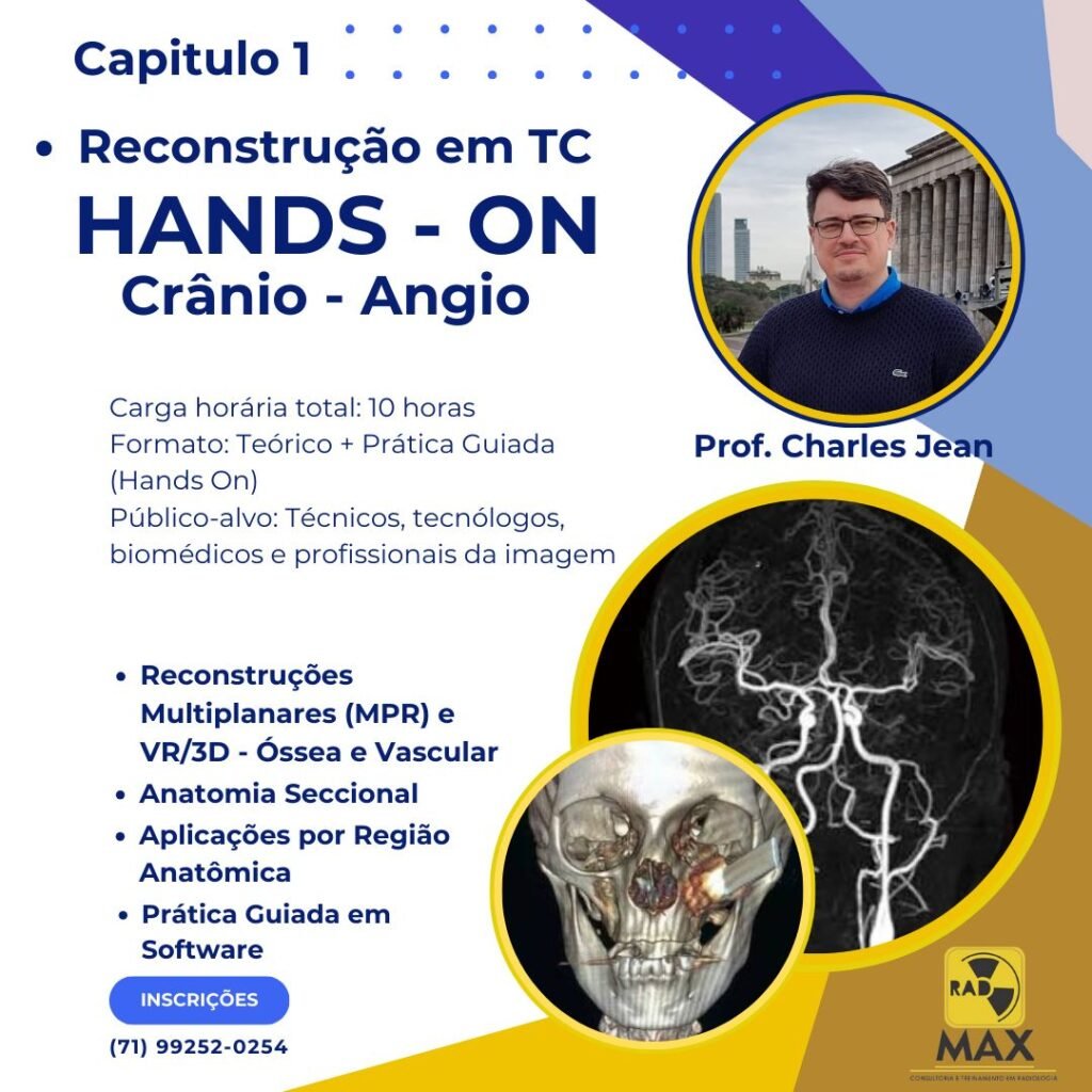 Curso Reconstrução em TC Hand-on Crânio e Angio