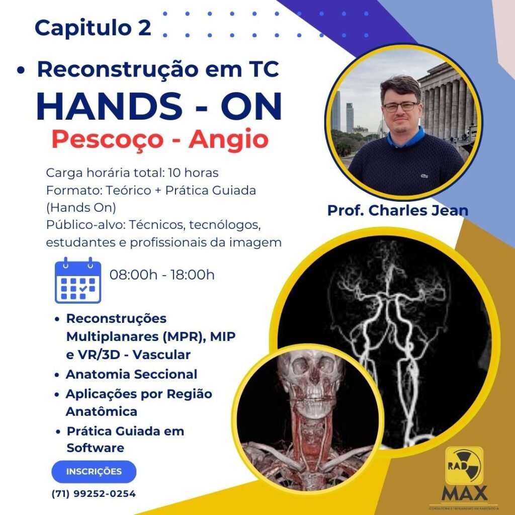 Maxad - TC HANDS-ON Pescoço - Angio